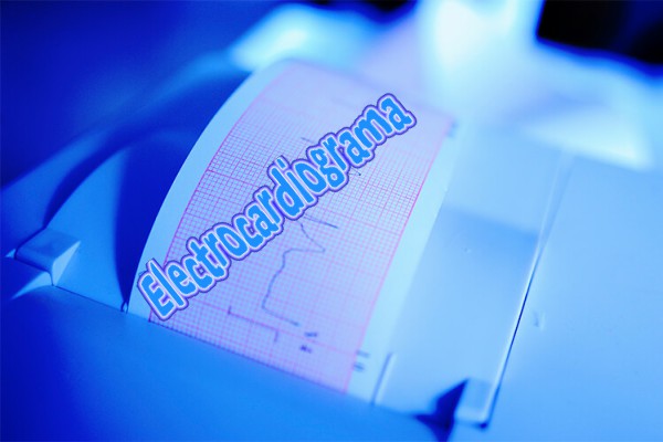 Electrocardiograma