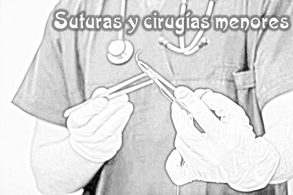 Suturas y cirugías menores