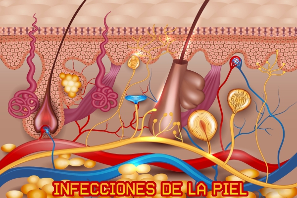 Infecciones de la piel