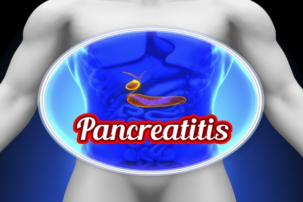 Pancreatitis