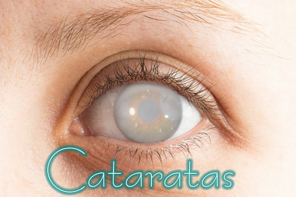 Cataratas