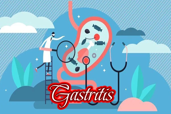 Gastritis